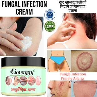 Govaggy Ayurvedic Malam Cream for Anti-Fungal Infection,Itching & Skin Recovery (Pk 1).