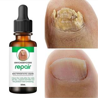 Estetica Nail Serum Boost Nail Strong & Repair Nails
