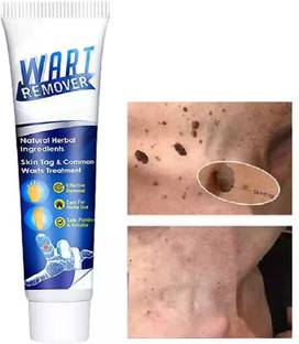 AFARAXIA Skin Tag Removal Cream