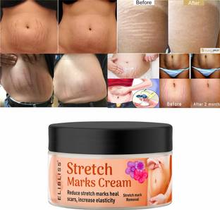ELIBLISS Stretch Marks Cream to Reduce Stretch Marks & Scars