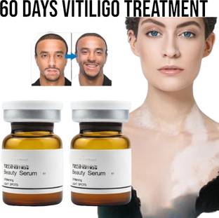 Adi Express Vitiligo Ointment Remove Spot Removal Upgraded White Spot Cream Skin Care Men & Women