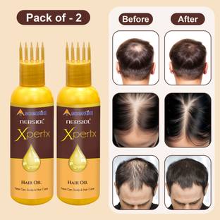 Nersiol Xpertx |Controls Hair Fall, Boosts Growth |With Bhringraj, Rosemary & Kalonji | Hair Oil