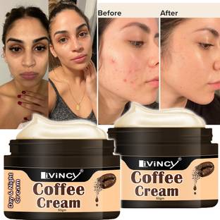 Livincy coffee face cream comboface glow cream for face acne removal creamskincare cream