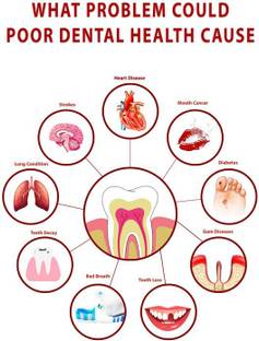 Poster Dental Dentist What Problem Could Poor Dental Health Cause Poster Wall Poster (300 Gsm Matte Paper, 13 X 19 Inch, Multicolour) Fine Art Print