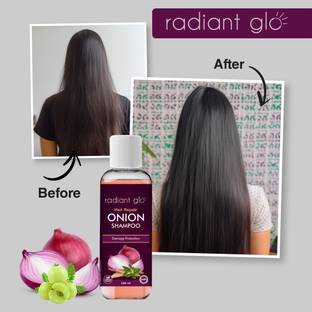 Radiant Glo Onion Shampoo - Hair Repair & Damage Protection | 100 ml x Pack of 3
