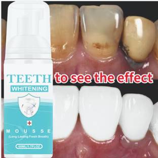 Latibule Teeth Whitening Liquid to Deeply Clean Gums Intensive Stain Removal Teeth Whitening liquid