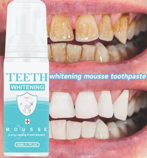 Sandarbh Teeth Whitening Foam To Remove Yellow Stains, Tartar and Tobacco Stains Teeth Whitening Kit