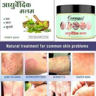 Govaggy Ayurvedic Anti-Fungal, Itch Coat Cream - 25Gm