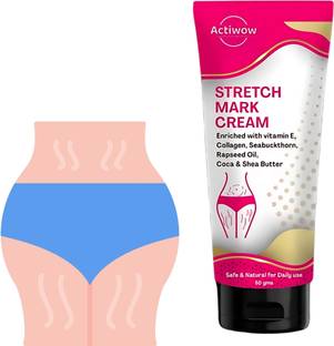 Actiwow New Stretch Marks Cream to Reduce Stretch Marks & Scars Cream