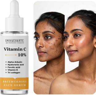 RoseBrite Brightening Vitamin C Serum – Repairs Pigmented, Uneven Skin & Boosts Skin’s Natural Radiance