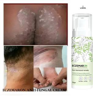 LORSHEL eczemaron fungal cream anti-fungal cream spray for easy use