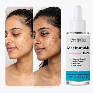 RoseBrite Oil Control Face Serum – Balances Sebum, Calms Sensitive Skin & Visibly Refines Pores Without Dryness