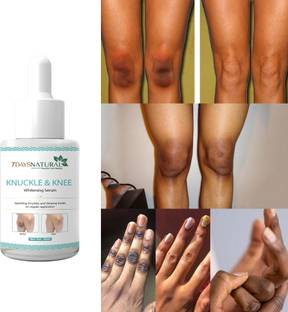 7 Days Dark Knuckles Elbow and Knee, Hand,Neck Whitening Serum For Removing