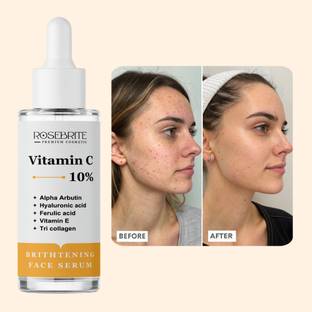 RoseBrite Vitamin C Anti-Melanin Face Serum – Reduces Pigmentation, Evens Tone & Promotes Skin Renewal for a Clearer, Brighter Complexion