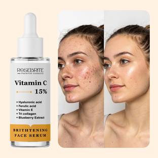 RoseBrite Radiance-Enhancing Vitamin C Serum – Lightens Spots & Improves Clarity