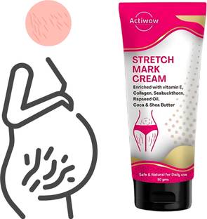 Actiwow All Natural Stretch Marks toner Repair Stretchmarks And Scars 50g Cream Body Scar Removee