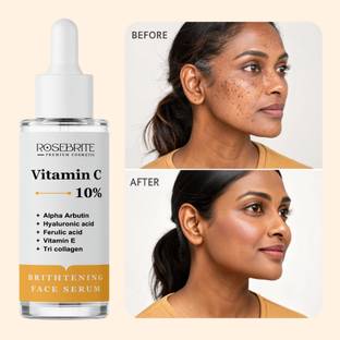 RoseBrite Vitamin C 10% Serum with Alpha Arbutin & Hyaluronic Acid – Deep Hydration, Brightening & Anti-Wrinkle Formula