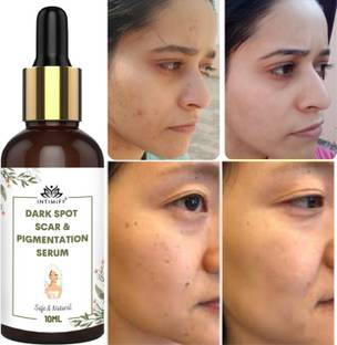INTIMIFY Pigmentation Removal Serum, Remove Dark Spots & Scars For Women & Men