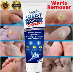 Alia Wart remover ointment Unique Cream Warts Remover