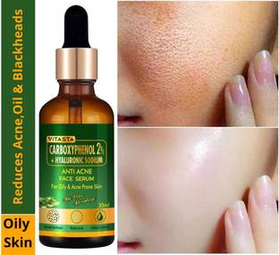 VITASTA Anti acne face serum,Excess oil control serum for Acne,Pimples,Black heads