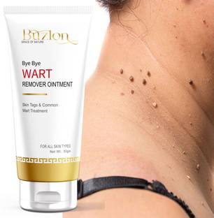 Buzlon Wart Treatment Unique Cream Warts Remover Ointment Skin Tag Removal