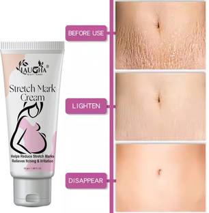 Laugha Stretch Marks Scar removal cream oil in during after pregnancy delivery women