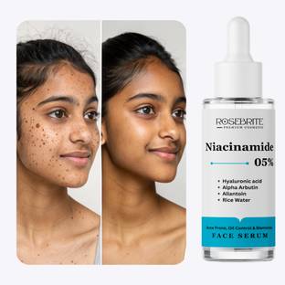RoseBrite Pigmentation Correcting Serum – Niacinamide 5%, Alpha Arbutin & Hyaluronic Acid for Bright, Calm & Clear Skin