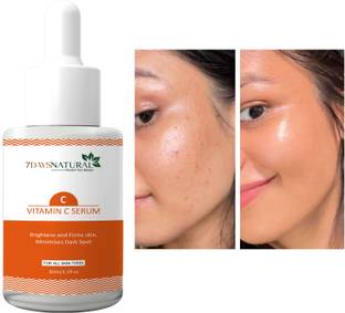 7days natural Vitamin C + E Face Serum For Brightening Skin | Niacinamide Acid | Fades Dark Spots | Acne Pimple | pigmentation Scar Marks Removals
