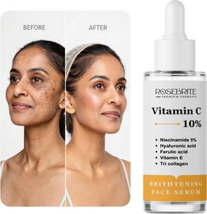 RoseBrite Vitamin C Face Serum – Instant Glow & Long-Term Brightness Support
