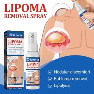 FEZONA Lipoma Healing Reduction Spray, Lipoma Removal Spray, Cream for Removing Lipomas, Relieves the Body of Fat Deposits