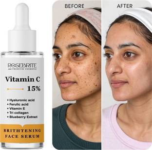 RoseBrite Vitamin C Radiance Serum – Targets Pigmentation, Dull Skin & Boosts Daily Glow