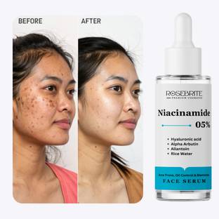 RoseBrite Ultimate Skin Brightening Serum with Niacinamide 5%, Alpha Arbutin and Long-Lasting Hyaluronic Acid Hydration