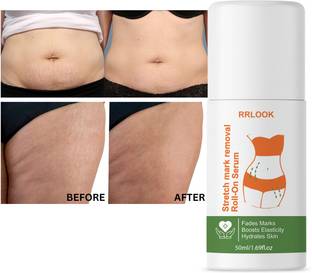 RRLOOK Stretch Marks Removal Roll-On Serum .