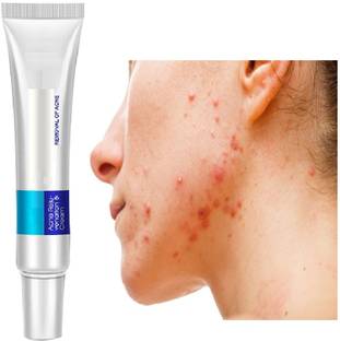 manasona Moisturizing Face Cream Skin Care Acne Treatment For Man &Man