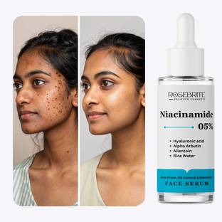 RoseBrite Multi-Correction Serum – Niacinamide 5%, Alpha Arbutin & Hyaluronic Acid for Brightening, Hydrating & Repairing Skin