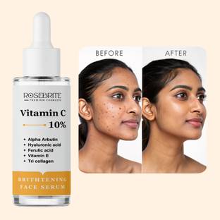 RoseBrite Anti-Pigmentation Vitamin C Serum – Fades Melasma, Freckles & Dark Patches While Boosting Skin’s Natural Radiance