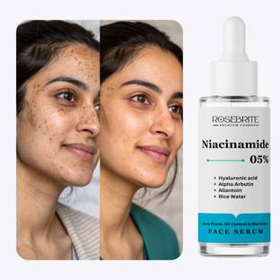 RoseBrite Niacinamide 5% Face Serum Enriched with Alpha Arbutin & Hyaluronic Acid – Reduces Pigmentation, Soothes Redness & Moisturizes Skin