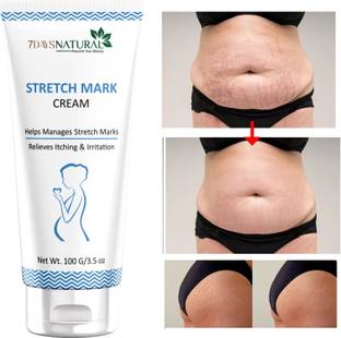 7days natural Say Goodbye to Stretch Marks with our Stretch Marks Cream Reduce� Scars