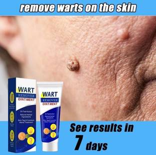 manasona Warts Remover Antibacterial Ointment Wart Treatment Cream