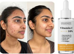 RoseBrite Anti-Wrinkle Vitamin C Serum – Minimizes Fine Lines, Boosts Radiance & Makes Skin Appear Silky Smooth & Soft
