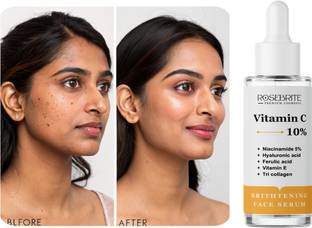 RoseBrite Silky Skin Serum – Vitamin C Reduces Lines & Adds Elasticity