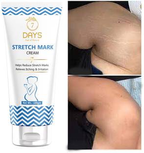 7 Days Anti-Stretch Marks |
