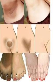 EVERERIN Bikini Skin Whitening And Darkness Reduction Cream For All Skin Type