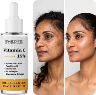 RoseBrite Vitamin C Face Serum – Restores Brightness, Boosts Collagen & Fades Dark Spots