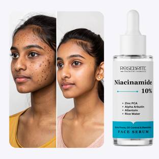 RoseBrite Skin Balancing Niacinamide 10% Serum – Fades Pigmentation, Reduces Pore Size & Controls Sebum with Zinc PCA & Alpha Arbutin