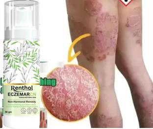 Renthol Eczemaron Fungal Cream For Men & Women Ayurvedic ItchCoat Anti fungal Malam for Ringworm itching Eczema cream (PACK - 1)