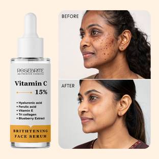 RoseBrite Vitamin C Serum for Bright Skin – Fades Marks, Evens Tone & Improves Elasticity