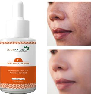 7days natural Vitamin C Face Serum - Skin Brightening Reduce dark spot, Pigmentation, Blemishes Removal serum