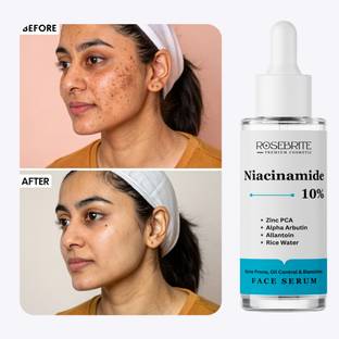 RoseBrite Lightweight Niacinamide 10% Serum – Refines Skin, Fades Spots & Clears Pores with Zinc PCA & Alpha Arbutin