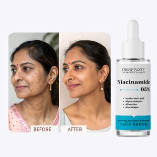 RoseBrite Vegan Glow Serum – Clinically Proven to Lighten Dark Spots, Hydrate & Restore Luminosity for All Skin Types